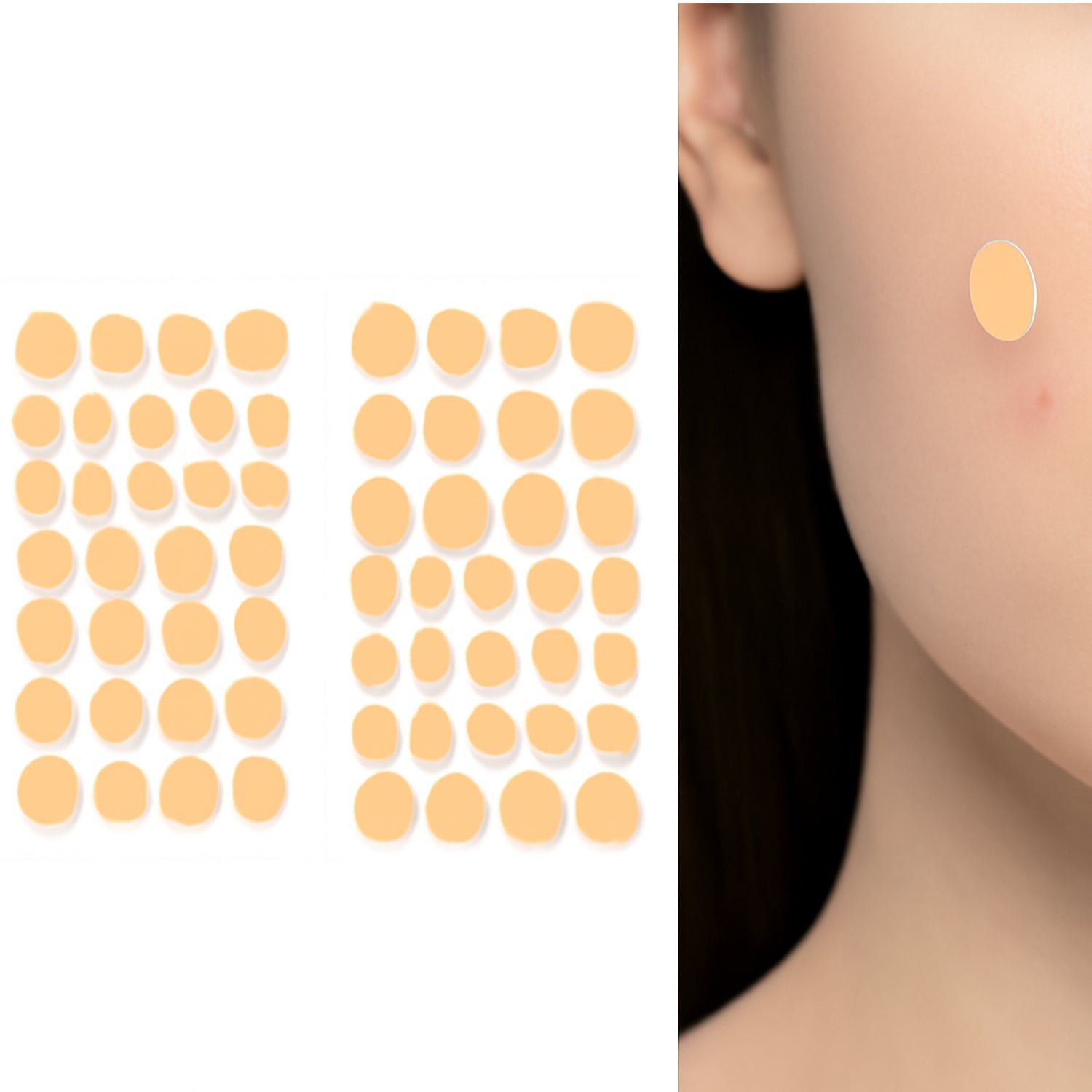 2_db358f8b-c366-4a36-a019-de6724b477d5.jpg GlowForm Pimple Patches for Face – 1 Sheet Set - Image 1